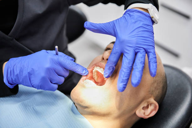 Best Emergency Gum Treatment in Bingham Farms, MI